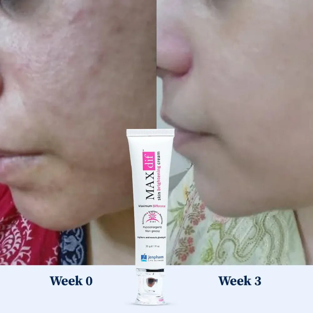 Jenpharm Maxdif Brightening Cream
