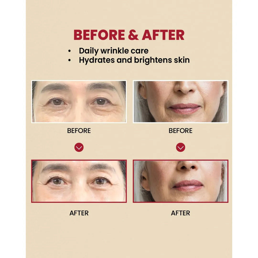 K-Secret SEOUL 1988 Cream Retinal Liposome 1% + Fermented Rice - Before After