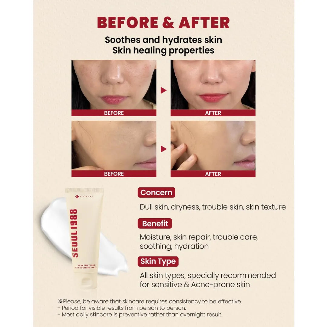 K-Secret SEOUL 1988 Cream Snail Mucin 93% + Rice - How to use