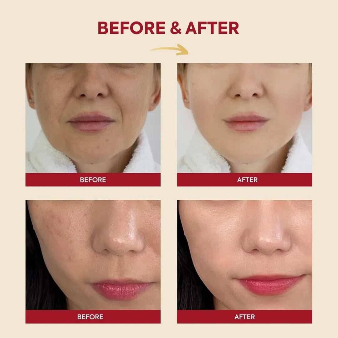 K-Secret SEOUL 1988 Essence Snail Mucin 97% + Rice